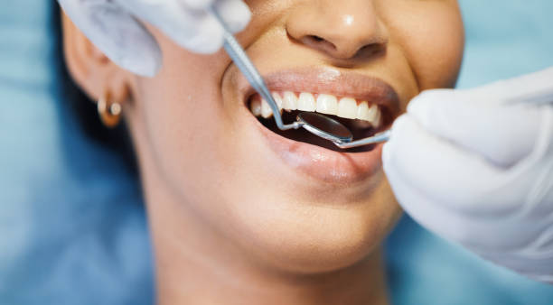 Best Emergency Dental Care for Sports Injuries in Nambe, NM