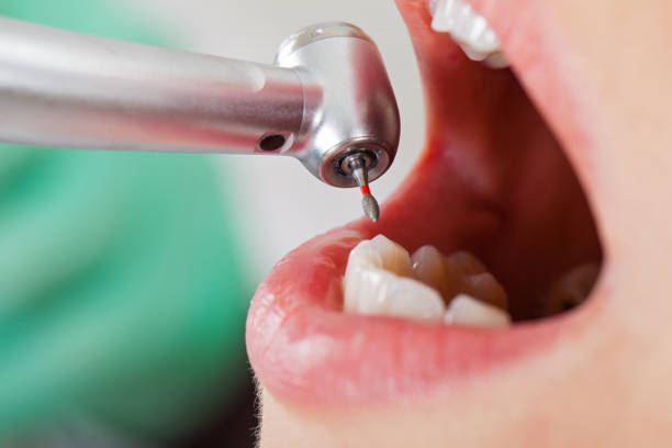 Best Broken or Chipped Tooth Repair in Nambe, NM